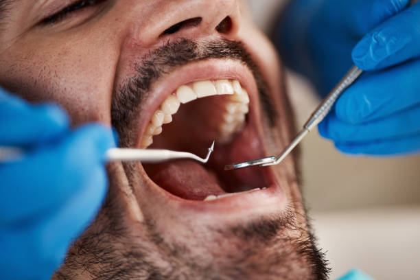 Best Cracked Tooth Emergency Dentist  in Summit View, WA
