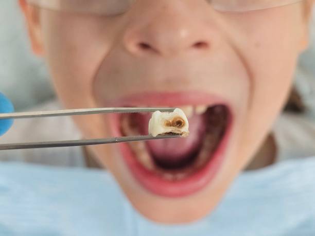 Best Tooth Pain Emergency Relief  in Summit View, WA