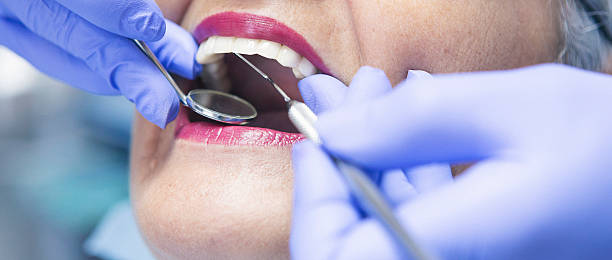 Best Chipped Tooth Repair Near Me  in Summit View, WA
